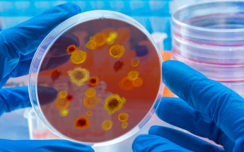 A technician holding up an agar plate with microbial colonies